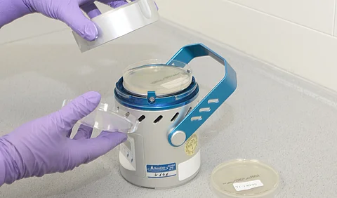 Mikrobiologische Untersuchung